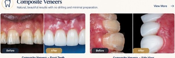 Эстетическая стоматология dental care in Hurghada